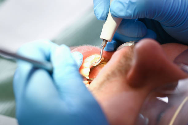 Best Emergency Dental Care for Sports Injuries in Brookville, PA