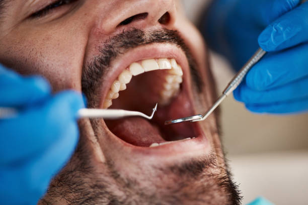 Best Dental Abscess Treatment in Brookville, PA